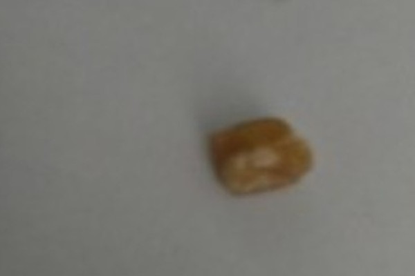 Homem é encontrado em hotel fumando crack após furto de celular no interior de carro