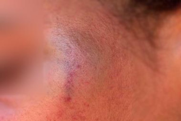 Garota de 12 anos é espancada e ameaçada com faca pelo padrasto; ele fugiu para a mata