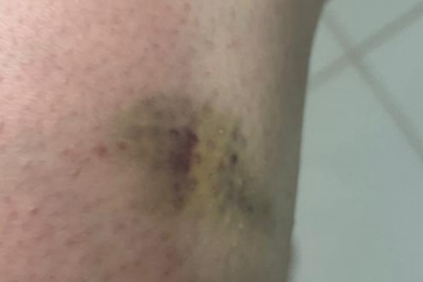 Homem que enviou 32 pix de R$0,01 para tentar burlar bloqueios é preso após enforcar ex no elevador de condomínio