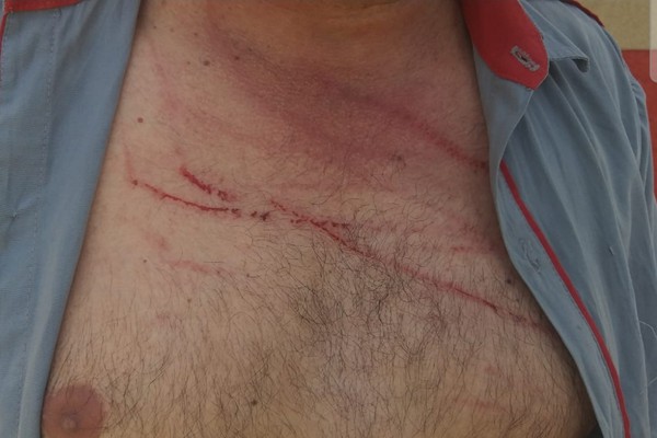 Mulher da unhadas no ex-companheiro, põe batata com pregos nos pneus de carro e acaba presa