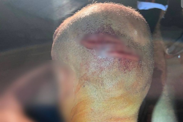 Homem é agredido com pedaço de madeira durante confraternização e fica desacordado, em Patos de Minas