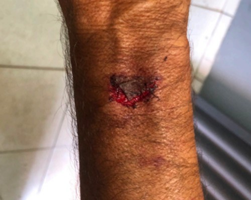 Homem é preso após agredir familiar durante confraternização na frente dos policiais e danificar viatura