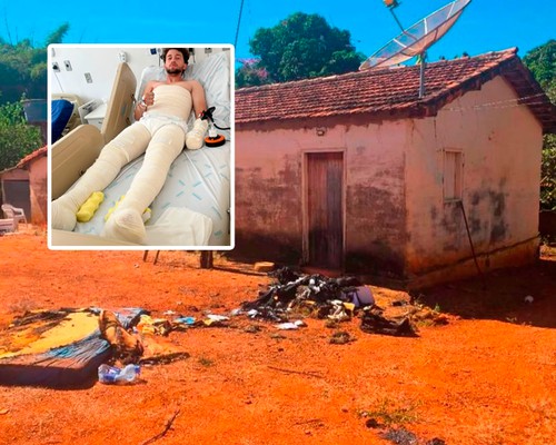 Jovem incendiado com gasolina pelo próprio amigo relata momentos de terror; família pede Justiça