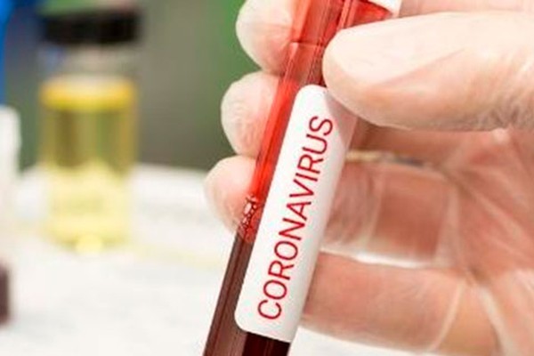 Patos de Minas tem mais uma morte por Covid-19 e registra mais 107 casos de coronavírus