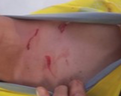 Homem é atacado com tesoura durante briga em barbearia e dois acabam presos em Patos de Minas