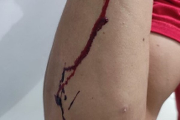 Mulher aciona a Polícia e diz que foi agredida pelo ex-companheiro; ele diz o contrário