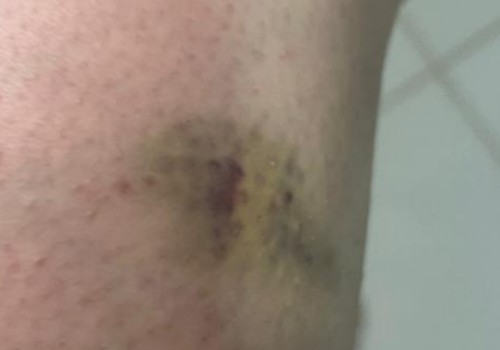 Homem que enviou 32 pix de R$0,01 para tentar burlar bloqueios é preso após enforcar ex no elevador de condomínio