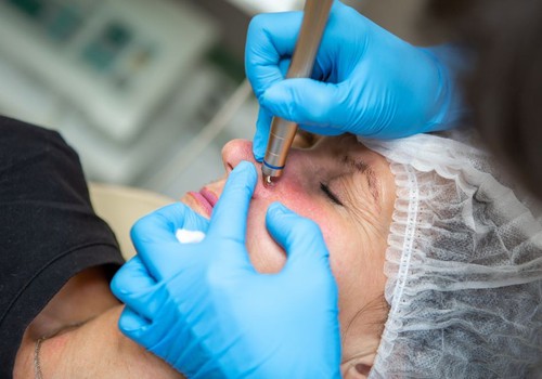 Clínica e esteticista devem indenizar cliente por uso de material errado para rejuvenescimento em MG