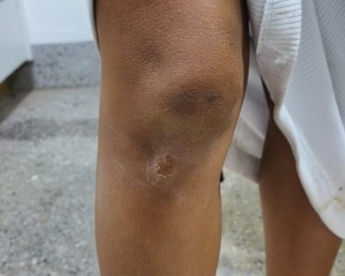 Obrigada a sair sem roupa, mulher é salva quando era ameaçada de morte embaixo de caminhão