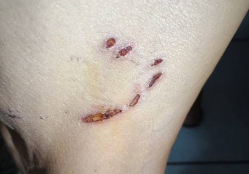 Idoso é atacado por 3 cães durante caminhada em Patos de Minas e caso acende alerta sobre animais soltos nas ruas