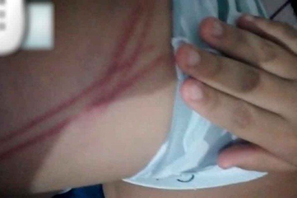 Denúncia mostra criança com diversas marcas de agressão em Patos de Minas