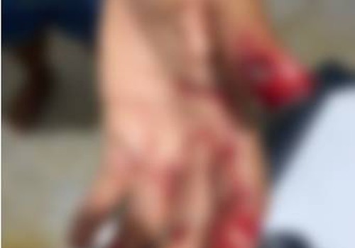Mulher vai contra marido consumir bebida alcoólica e acaba agredida em São Gonçalo do Abaeté