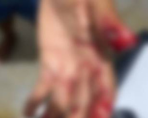 Mulher vai contra marido consumir bebida alcoólica e acaba agredida em São Gonçalo do Abaeté