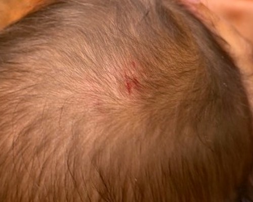 Homem é preso por agredir companheira e provocar ferimento na cabeça do filho bebê em Patos de Minas