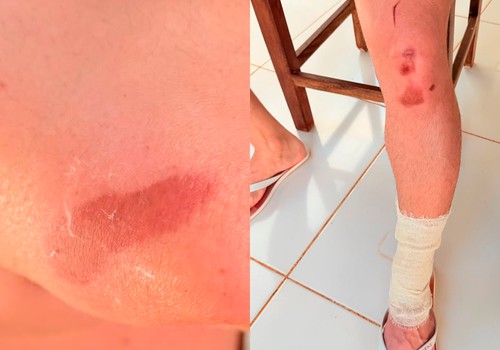 Motorista tenta impedir fuga após batida, é atropelado e condutor foge sem prestar socorro em Patos de Minas