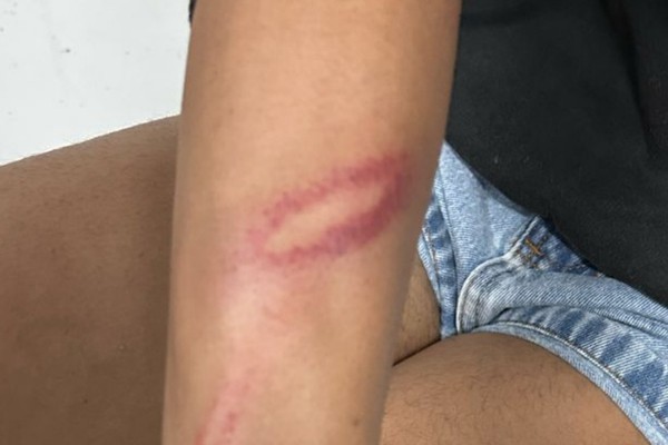 Marido e mulher trans se agridem com socos, tapas, mordidas e pauladas e os dois vão parar na Delegacia