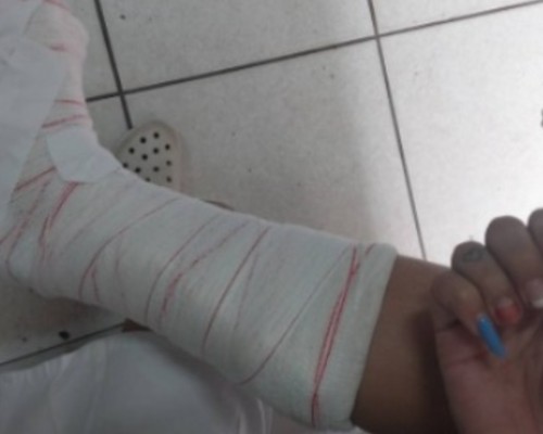 Briga entre duas mulheres no Centro termina em ferimentos e apreensão de canivete
