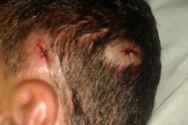 Homem de 35 anos leva tiro na cabeça ao tentar separar briga no Bairro Mateus Caixeta em Presidente Olegário