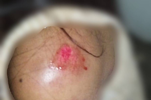 Mulher se nega a "fazer amor" no carro e é agredida pelo companheiro em Patos de Minas