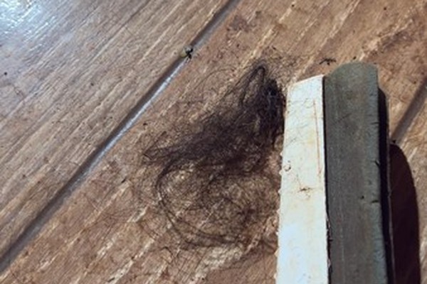 Mulher é atropelada duas vezes, espancada e tem tufos de cabelo arrancados pelo marido que acabou preso