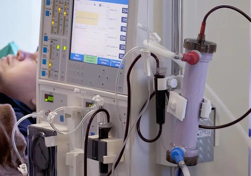 Estudo alerta para subdiagnóstico da doença renal crônica no Brasil