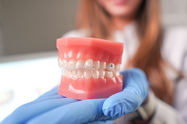 Orthodontic comemora parceria de sucesso com o Invisalign aparelho ortodôntico invisível