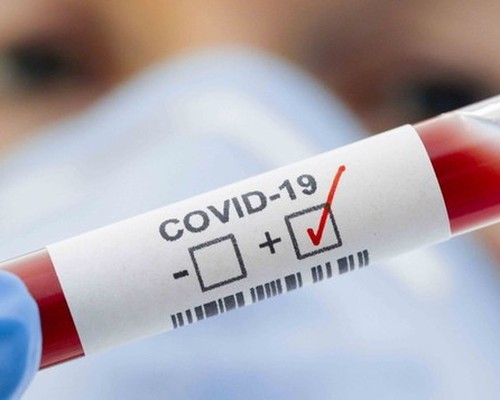 Patos de Minas tem novos 53 casos de Covid-19, e pacientes voltam a ser internados em UTIs