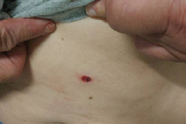 Idoso de 80 anos é preso após agredir e desferir golpes de chave de fenda na companheira