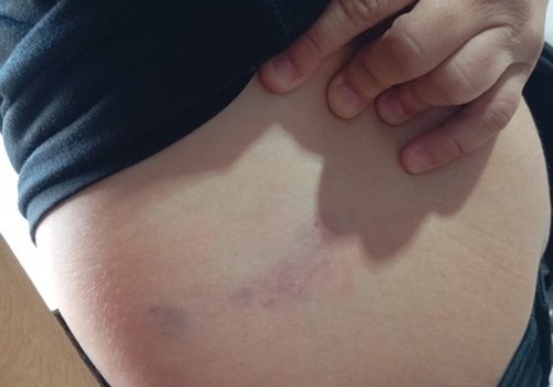 Mãe tenta defender filha, é agredida pelo irmão e vai parar no hospital em Patos de Minas