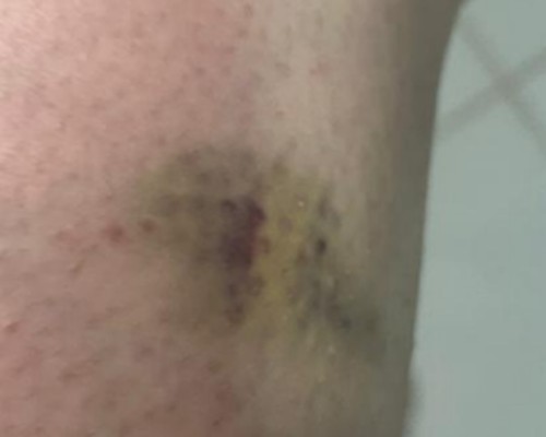 Homem que enviou 32 pix de R$0,01 para tentar burlar bloqueios é preso após enforcar ex no elevador de condomínio