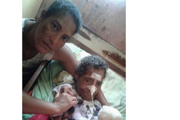 Família pede doação de suplemento para senhora de 79 anos com desnutrição em Lagoa Formosa 