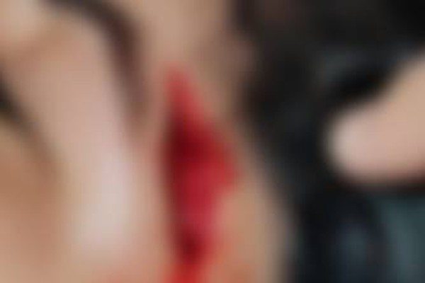 Jovem tenta apaziguar confusão, é agredida com capacetada e sofre grande corte na cabeça, em Patos de Minas