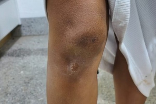 Obrigada a sair sem roupa, mulher é salva quando era ameaçada de morte embaixo de caminhão