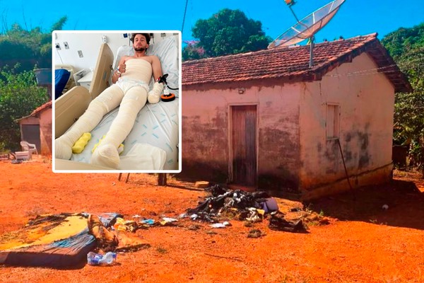 Jovem incendiado com gasolina pelo próprio amigo relata momentos de terror; família pede Justiça