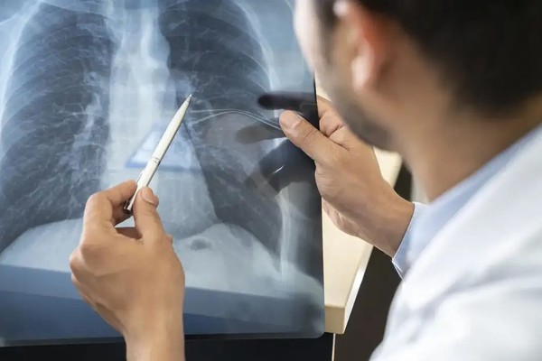 Tabagismo é maior entre jovens de 16 a 24 anos, alerta pesquisa