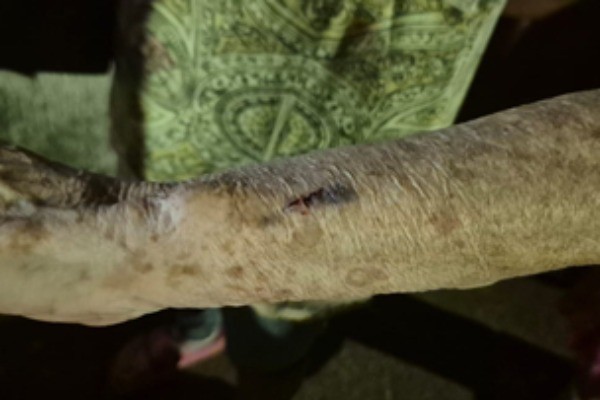 Filho agride a própria mãe de 76 anos no Dia Internacional das Mulheres em Patos de Minas