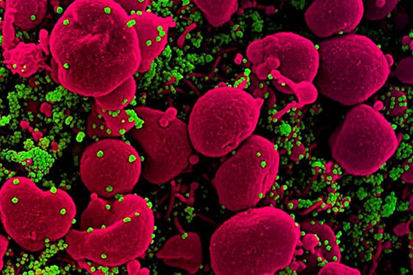 Patos de Minas tem mais 11 casos confirmados de coronavírus em um único dia