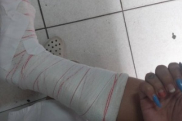 Briga entre duas mulheres no Centro termina em ferimentos e apreensão de canivete