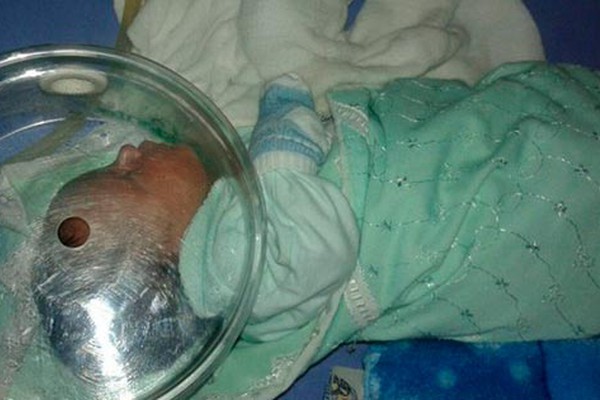 Sem vaga em UTI Neonatal, recém-nascido corre risco de morte em Carmo do Paranaíba