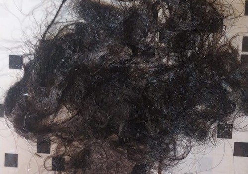 Após ser atropelada, espancada e ter cabelos arrancados, mulher entra em pânico com liberdade do ex-companheiro