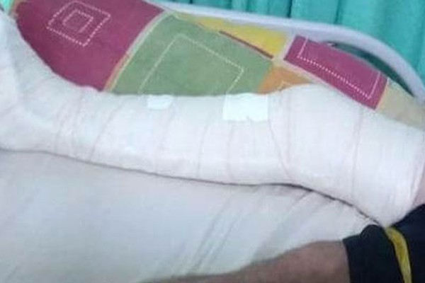 Paciente com fratura na perna espera transferência para realizar cirurgia e pede socorro em Patos de Minas