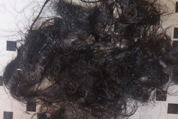 Após ser atropelada, espancada e ter cabelos arrancados, mulher entra em pânico com liberdade do ex-companheiro