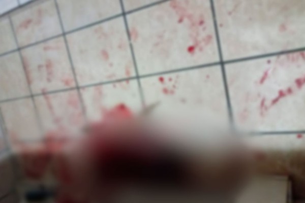 Mulher é brutalmente agredida a socos e golpes de faca pelo próprio companheiro em Lagamar