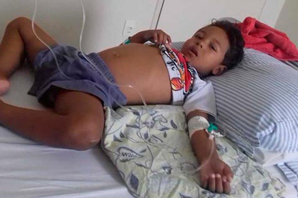 Família pede ajuda urgente para garotinho com tumor no rosto em Patos de Minas