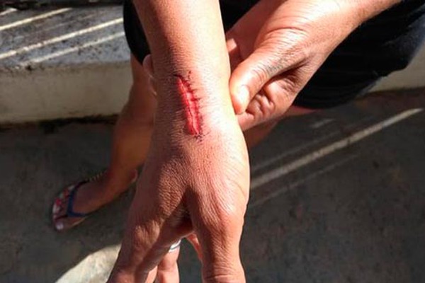 Após separação, mulher é agredida e esfaqueada pelo ex-marido em Carmo Paranaíba
