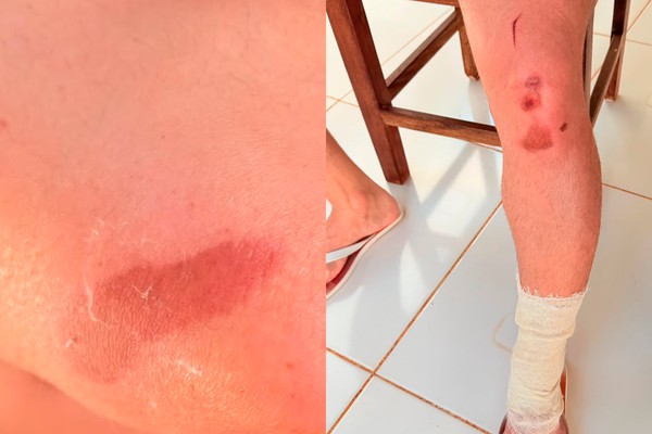 Motorista tenta impedir fuga após batida, é atropelado e condutor foge sem prestar socorro em Patos de Minas