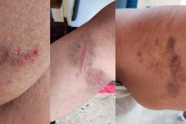 Casamento em crise: casal é preso após briga com agressões mútuas em Patos de Minas