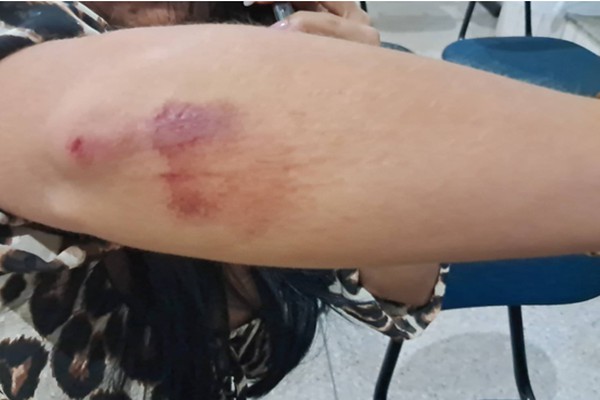 Comerciante é preso por arrastar esposa no asfalto após discussão por ciúmes em Patos de Minas