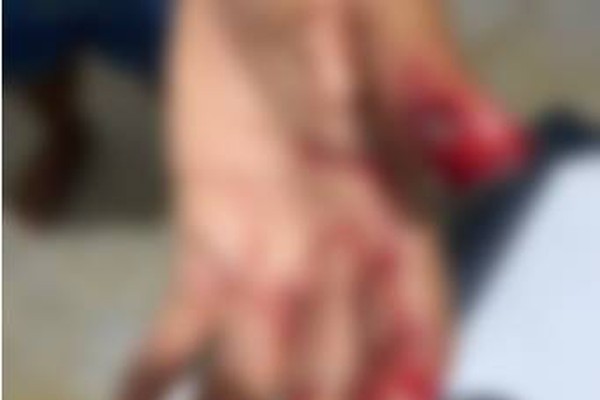 Mulher vai contra marido consumir bebida alcoólica e acaba agredida em São Gonçalo do Abaeté
