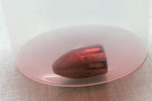 Morador fica ferido ao ser atingido por bala perdida no bairro Céu Azul, em Patos de Minas